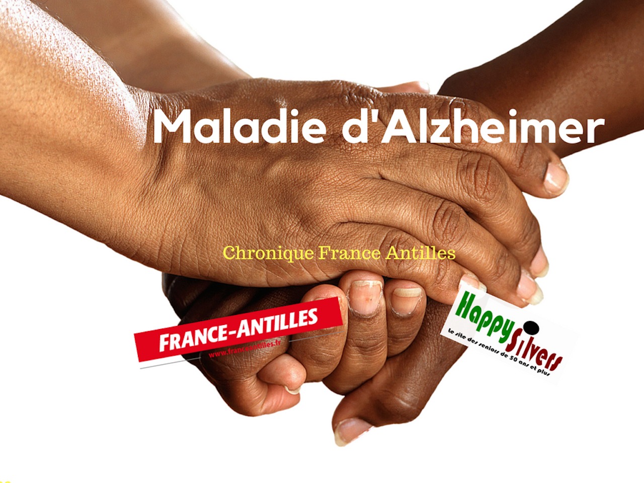 Alzheimer chronique