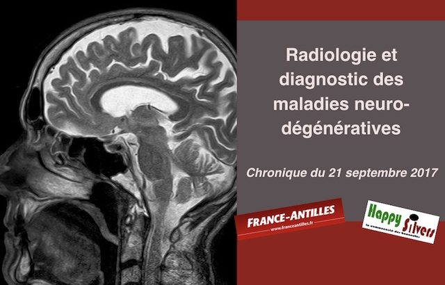 chronique du 21 septembre 2017 diagnostic