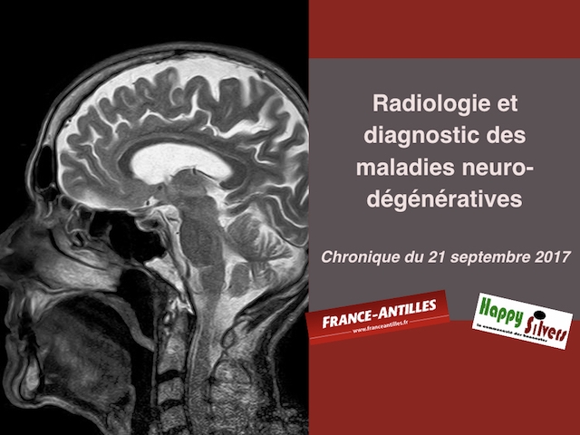 chronique du 21 septembre 2017 diagnostic