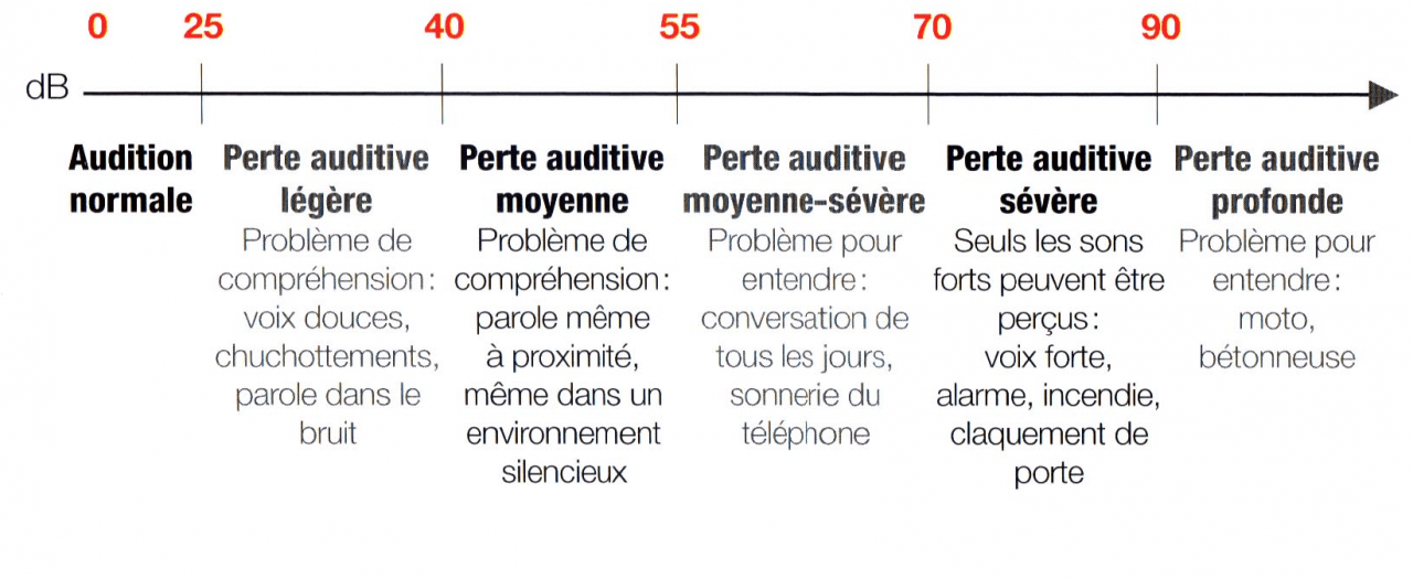 les-differents-degres-de-perte-auditive